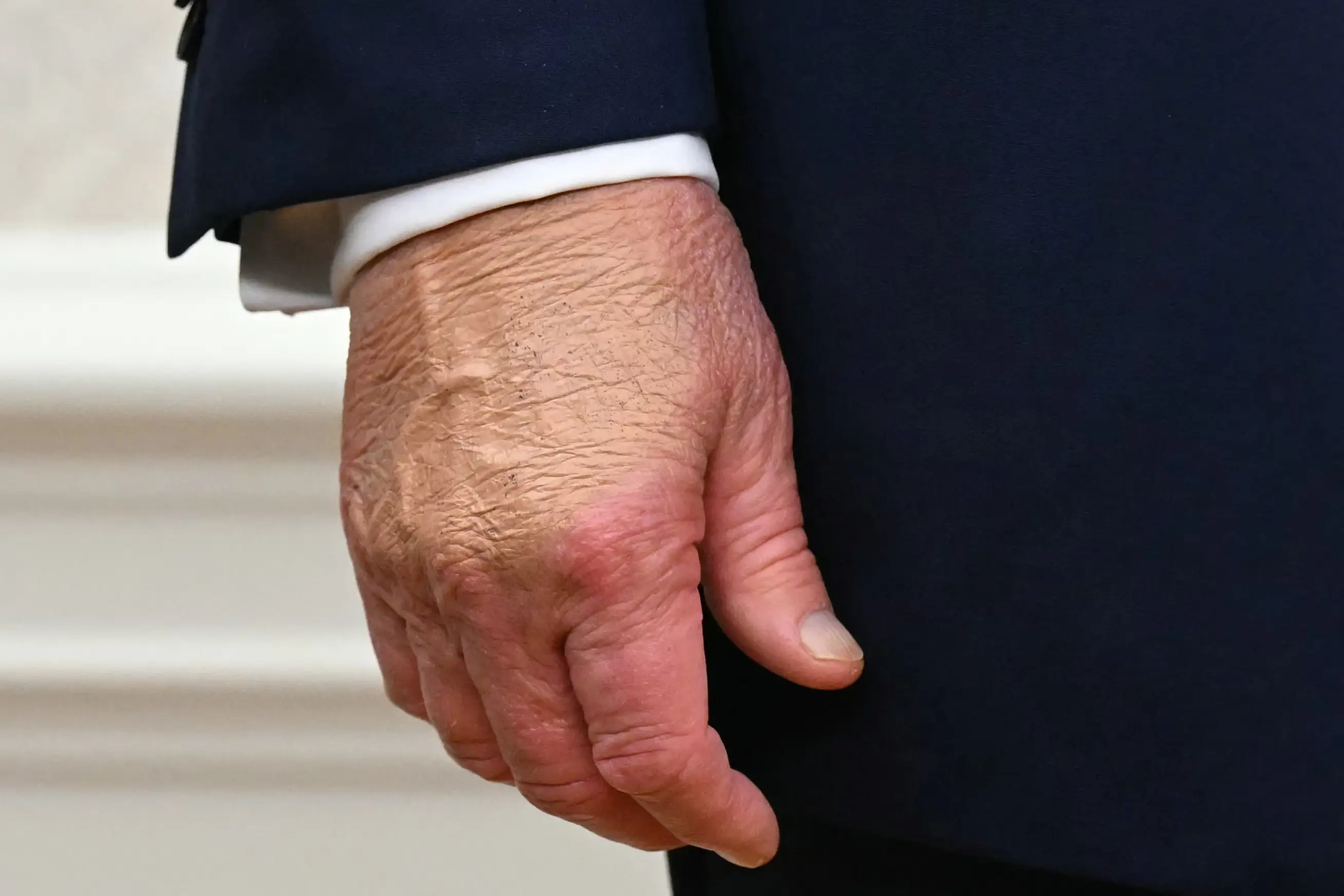 Concerns were raised for Trump's health after images of him wearing blotches of makeup on his hand were spotted (SAUL LOEB/AFP via Getty Images)