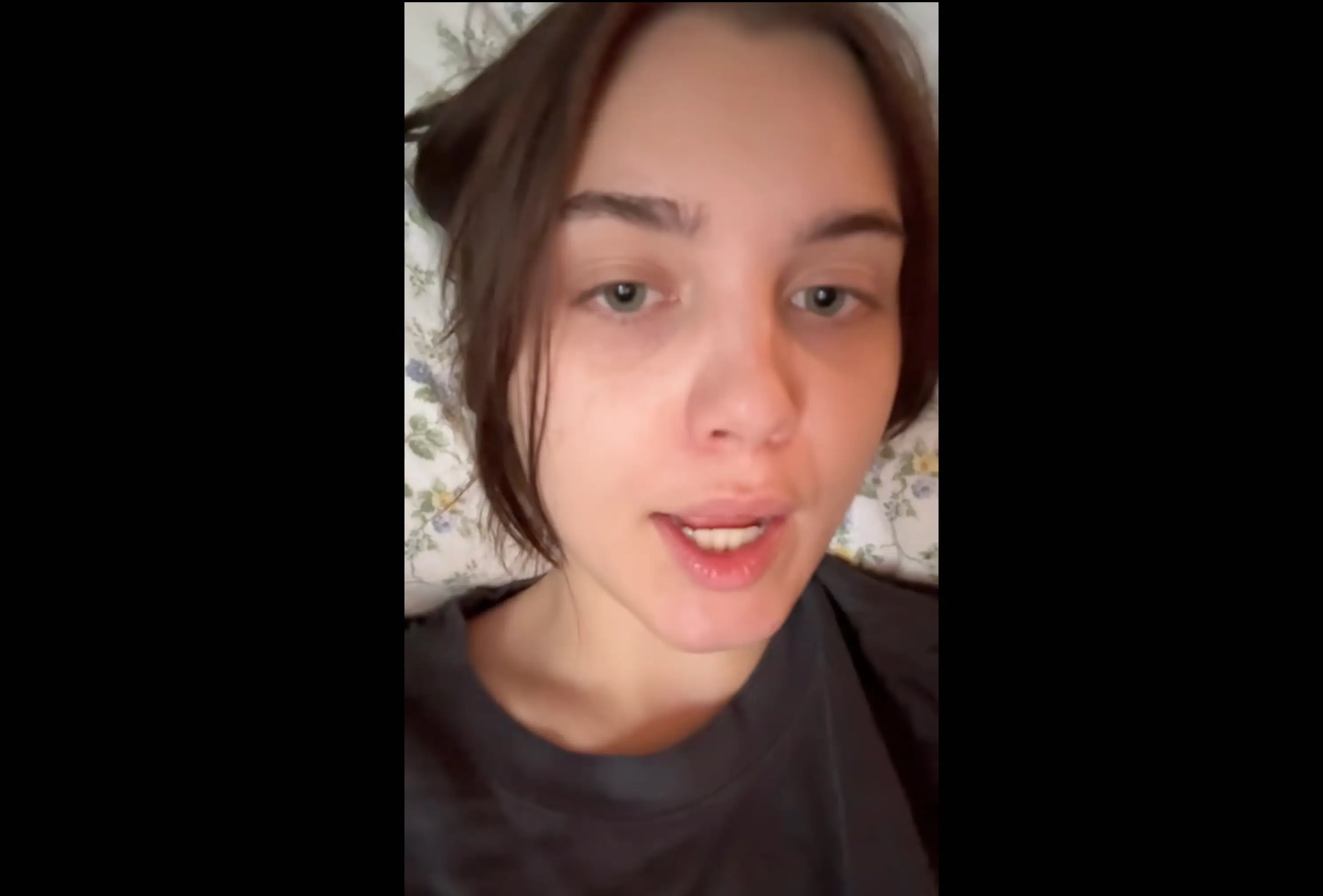 The TikToker recalled how she ate her own rib meat after having surgery to remove it (TikTok/@pterodactylhunny)