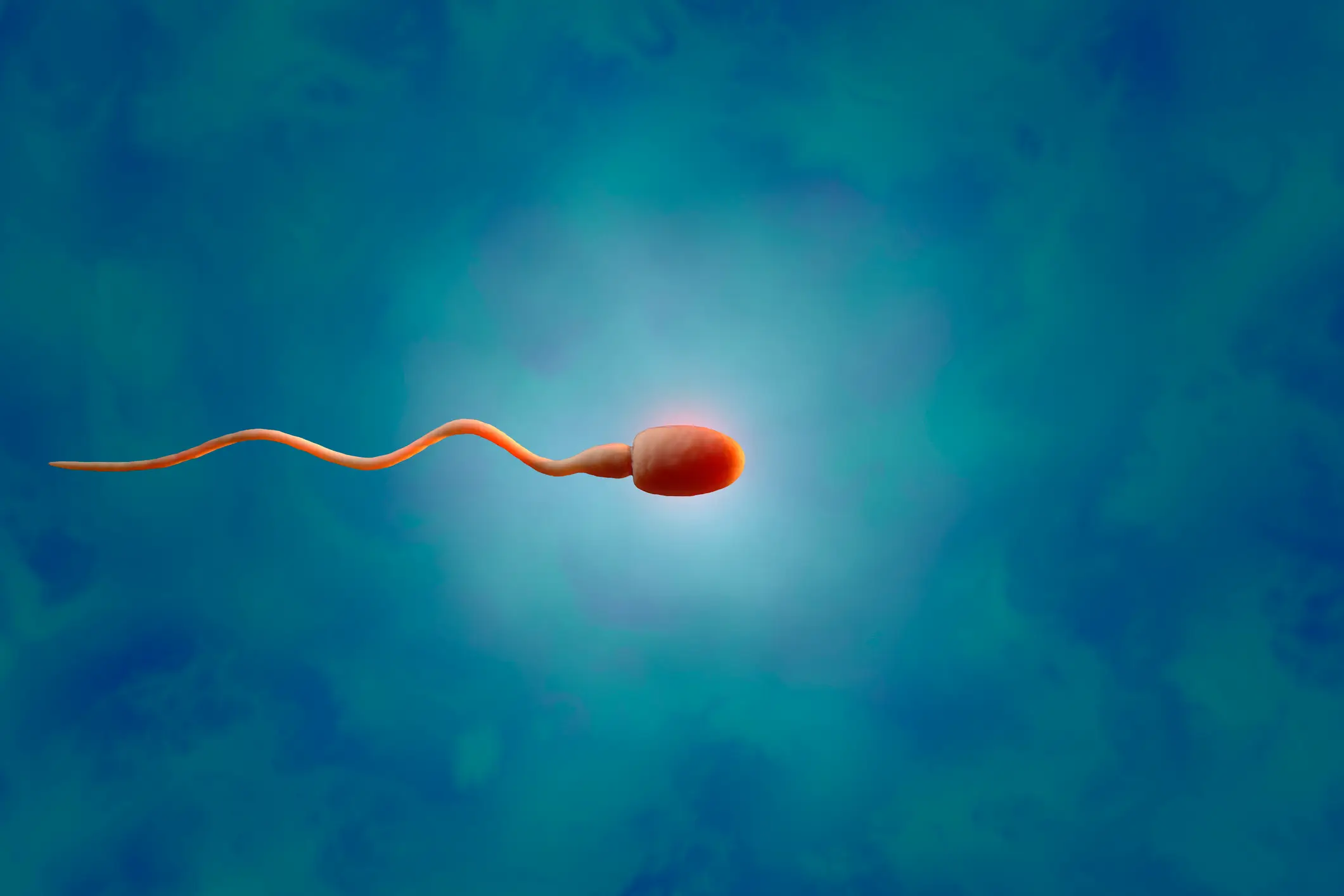 Azoospermic individuals produce zero visible sperm within their ejaculate, often relating to early-life radiation-based treatments (Getty Stock)