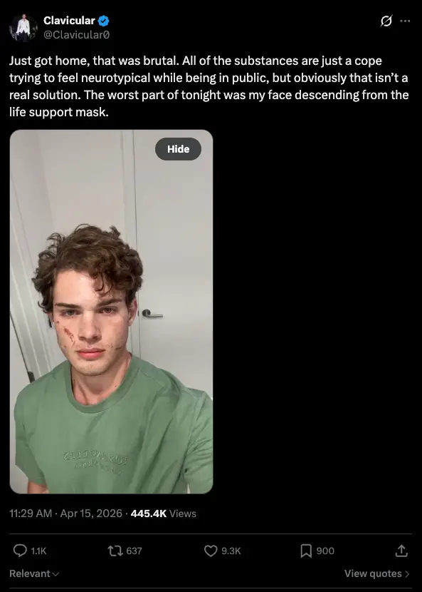 Clavicular has broken his silence after he was rushed to hospital following a suspected overdose (X/Clavicular0)