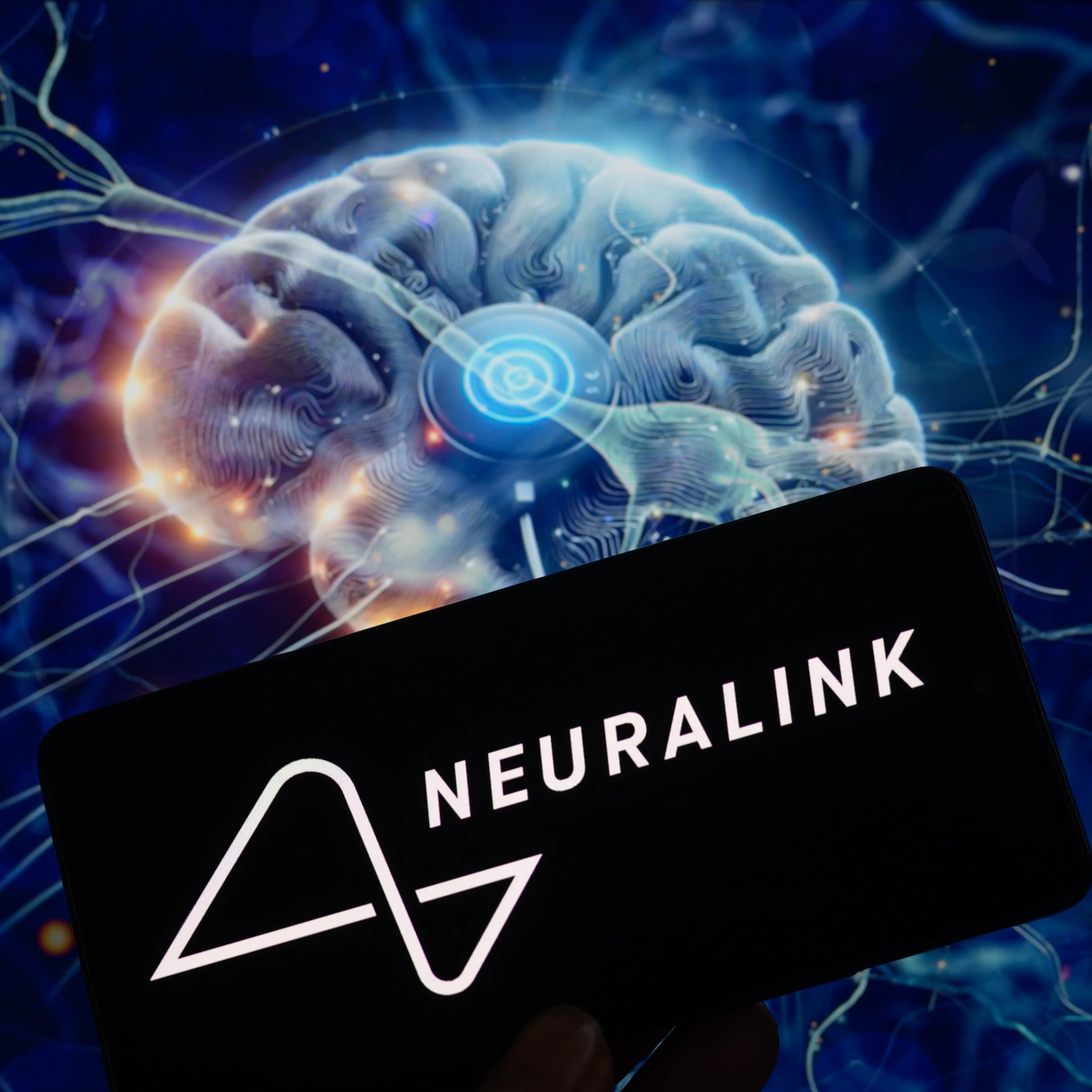 NurPhoto / Contributor / Getty 