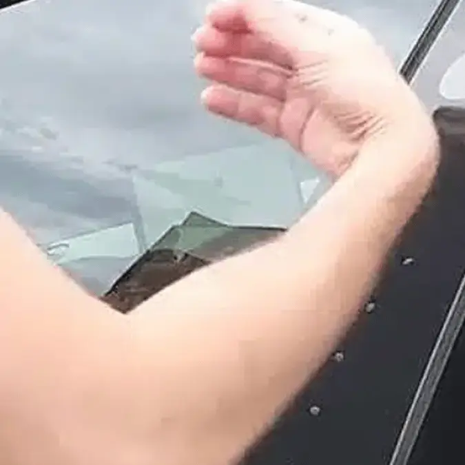 Tesla owner spent $400 having key implanted into his hand so 'he’ll never forget it'