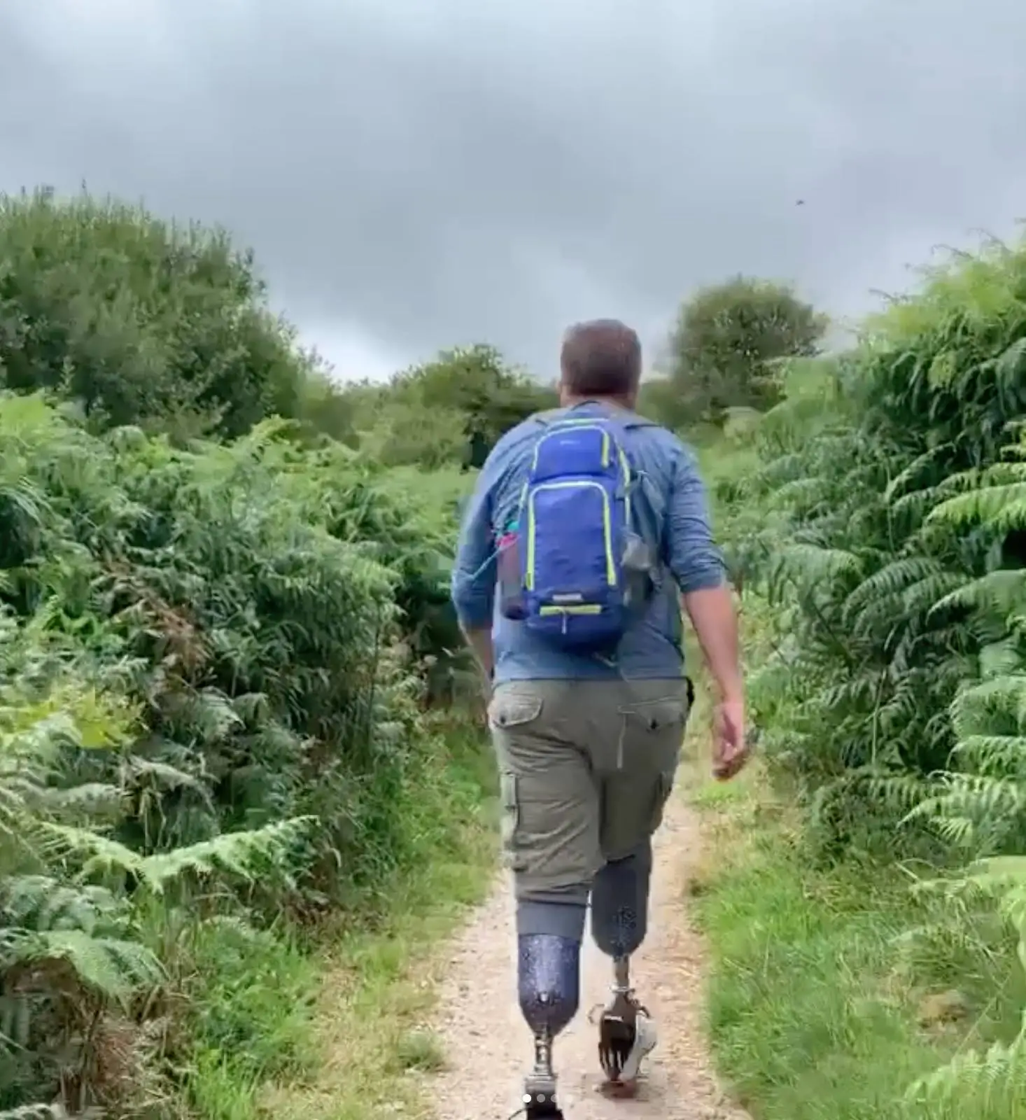 Hopper regularly shared his life as an amputee on Instagram (Instagram / bionicsurgeon)