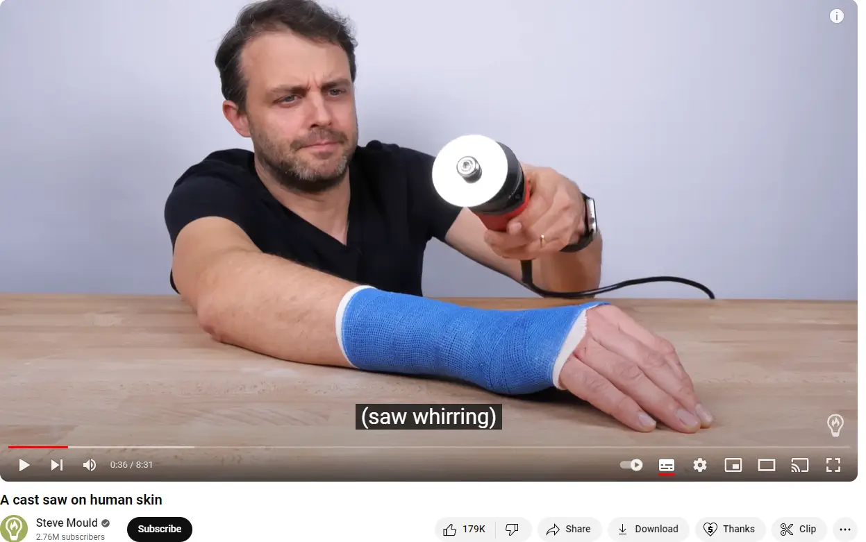A cast saw won't cut through human skin.