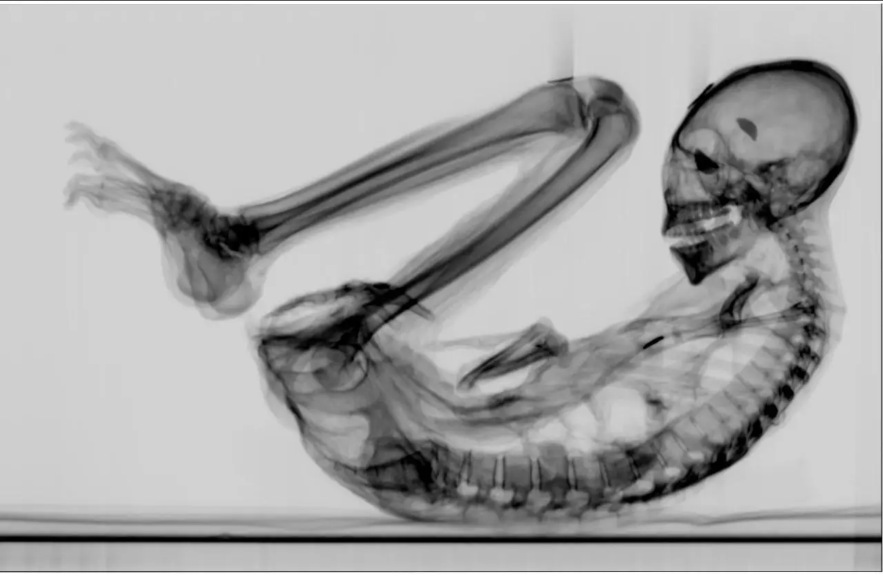 A medical scan of the Montserrat tridactyl (Tridactyls.org)