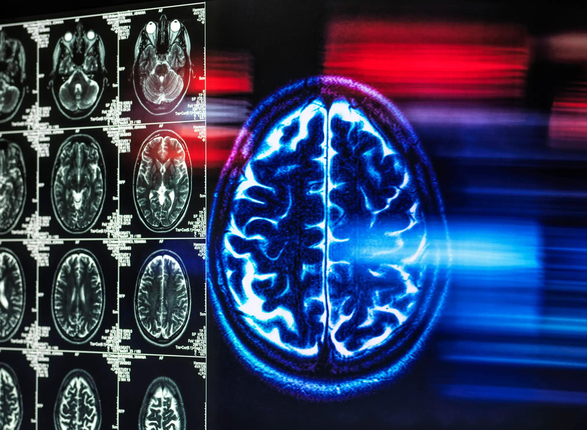 The memory ability of 331 participants were put to the test in an experiment (Westend61/Getty Images)