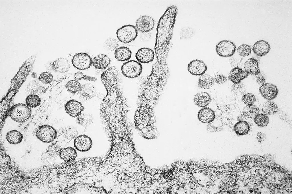 Hantavirus symptoms take around a week to emerge after infection, yet the dangers ramp up quickly after that (Smith Collection/Gado/Getty Images)