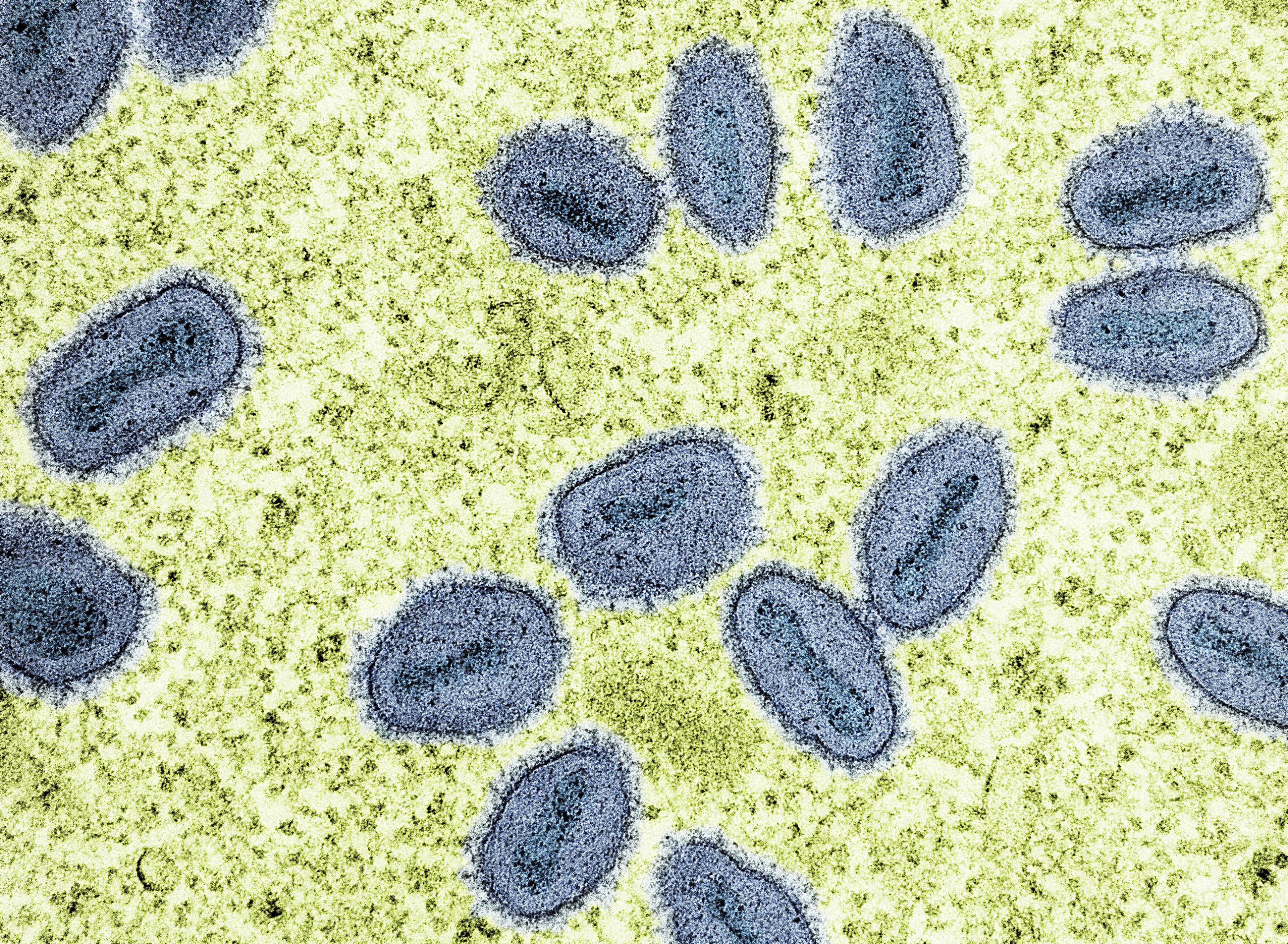 Two scientists have been charged with allegedly smuggling a deadly virus into the US (NIH-NIAID/Image Point FR/BSIP/Universal Images Group via Getty Images)
