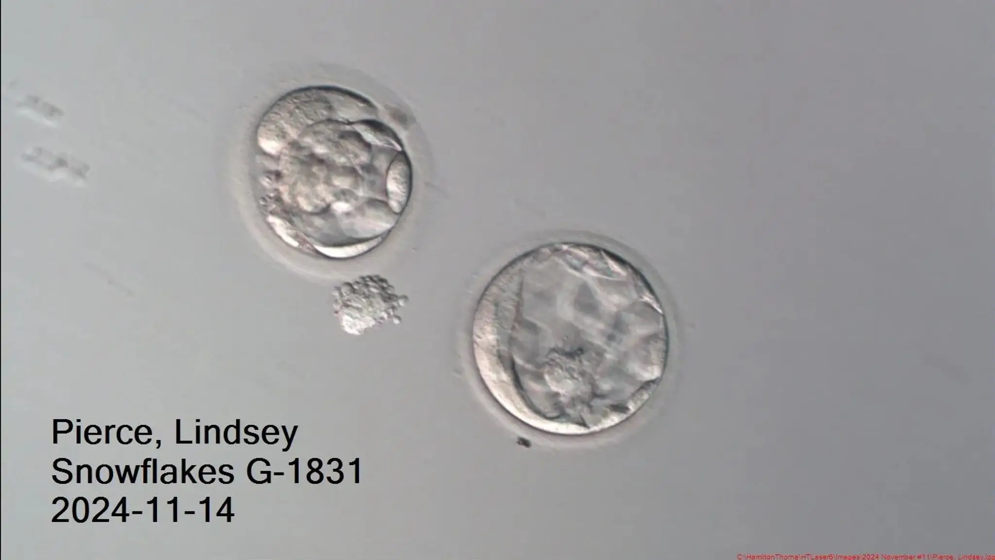 Thaddeus is the oldest baby to be born (Sky News/Rejoice Fertility)