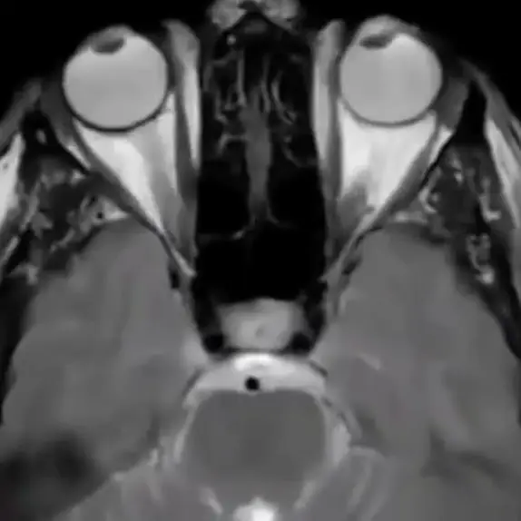 Video of how our eyes look during REM sleep is seriously freaking people out