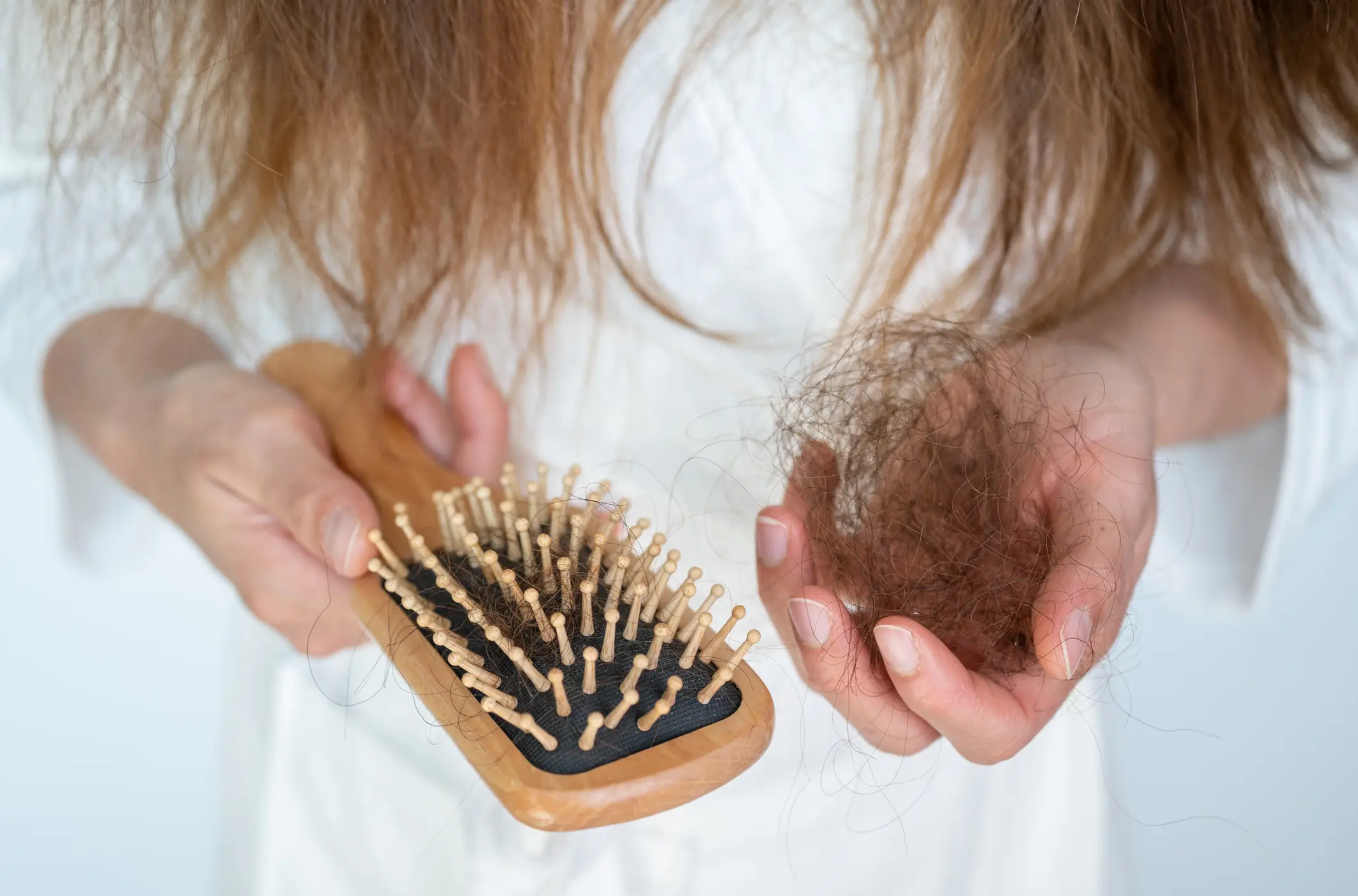 Hair loss has recently emerged as one of the biggest concerns associated with weight loss jabs (Getty Images)
