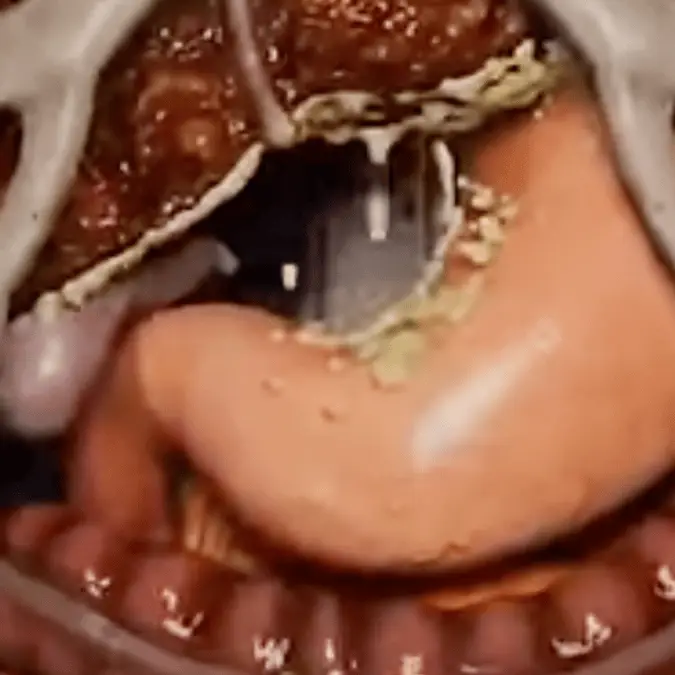 Wellness Wise / YouTube