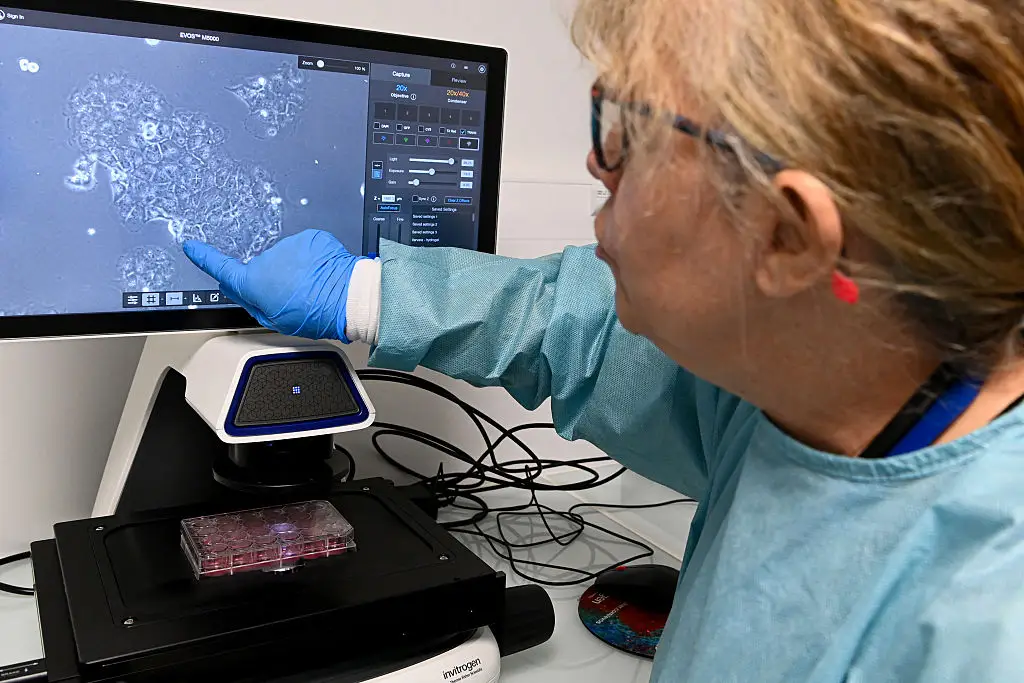 Pancreatic cancer is one of the most dangerous forms of the disease, specifically for its resistance to treatment (Jean-Francois Monier/AFP via Getty Images)