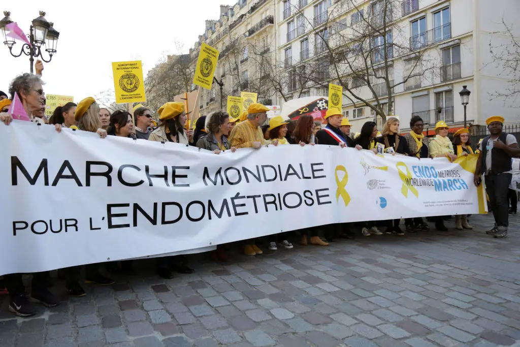 Endometriosis is a disease that impacts around 10% of women worldwide, and for most it takes years to receive a diagnosis (Zakaria Abdelkafi/AFP via Getty Images)