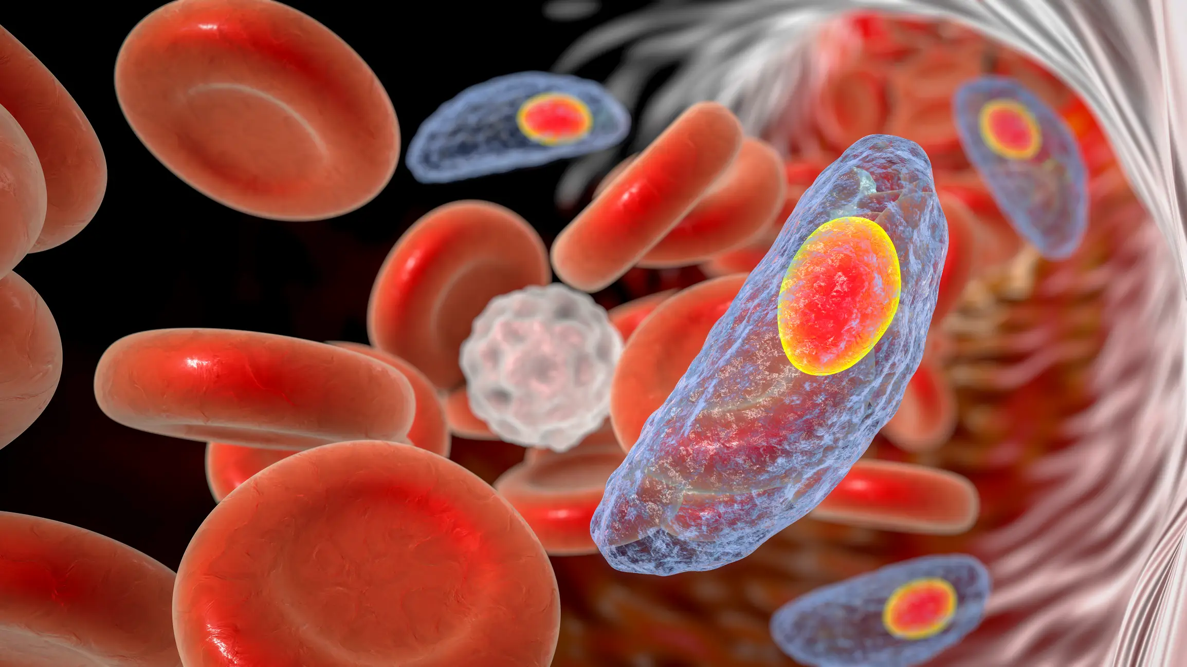 Toxoplasma gondii has no cure (KATERYNA KON/SCIENCE PHOTO LIBRARY/Getty Images)