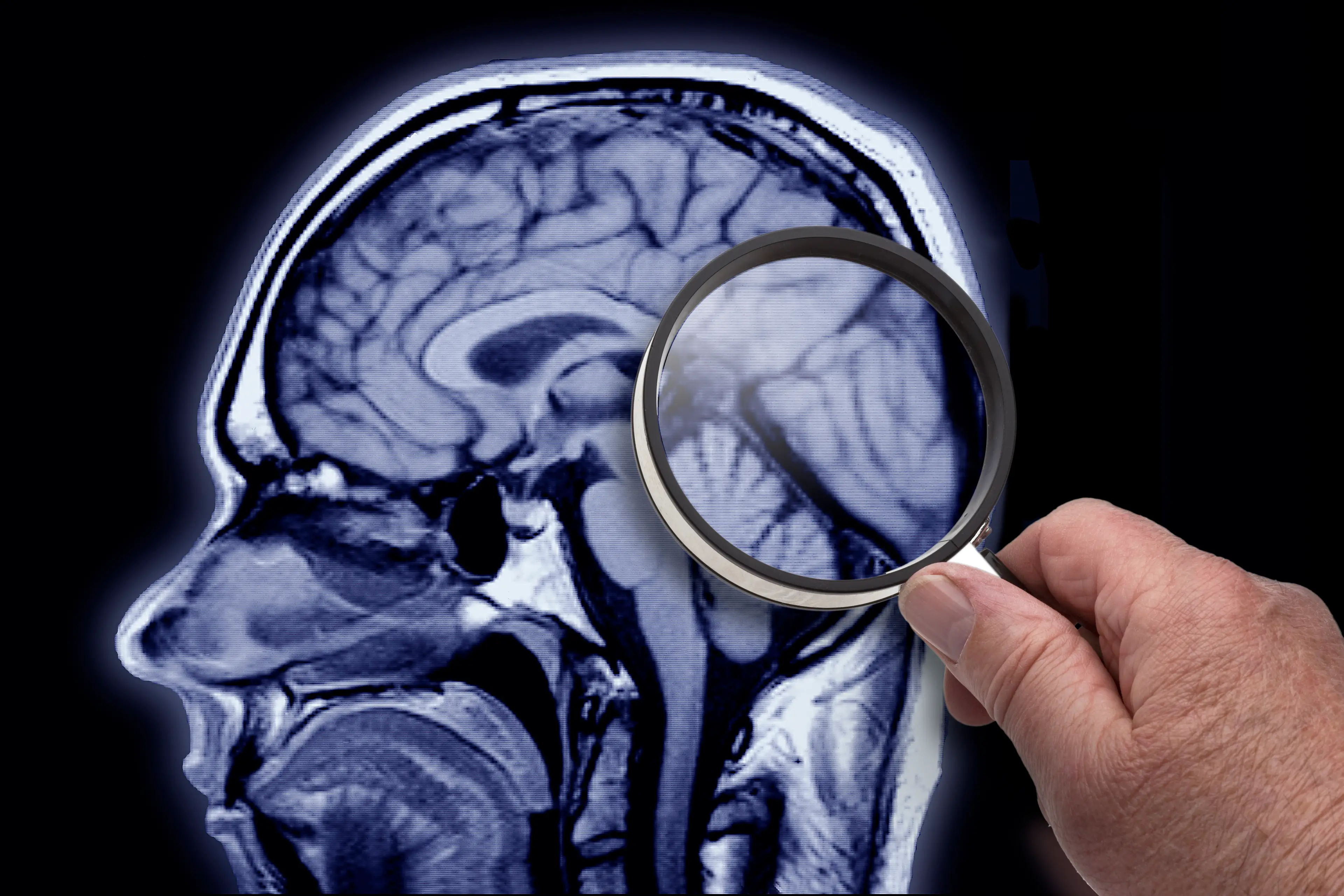 It's fair to say the brain is fascinating (Getty stock image)
