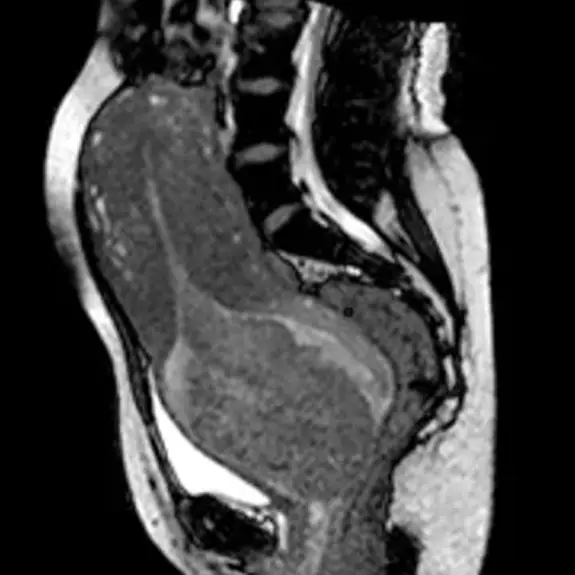 Woman gave birth inside MRI scanner to reveal the mechanics of childbirth in insane first