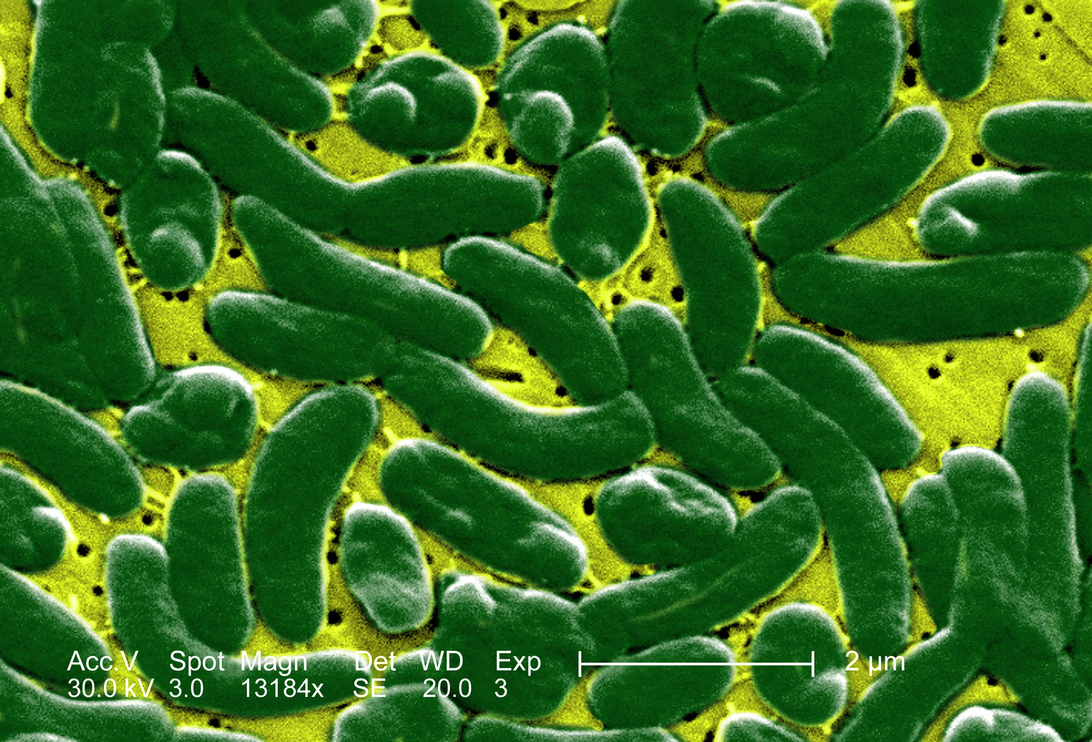 Vibrio vulnificus especially thrives in warm salt and brackish water (BSIP / Getty)