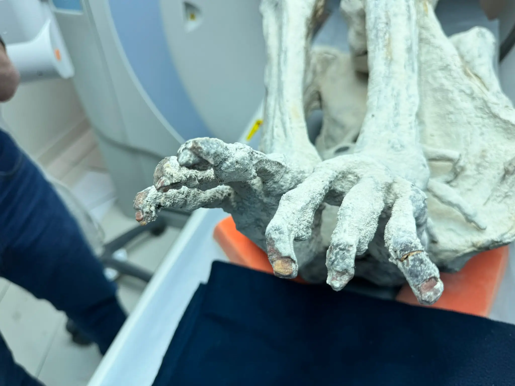 The strange mummies only have three fingers (X/@pikespeaklaw)
