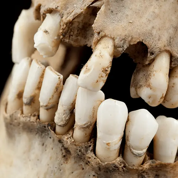 How people cleaned their teeth before toothpaste was invented is not how you'd expect