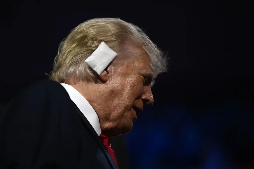 The health report highlights the scarring present on Trump's right ear following the assassination attempt in July 2024 (Brendan Smialowski/AFP via Getty Images)