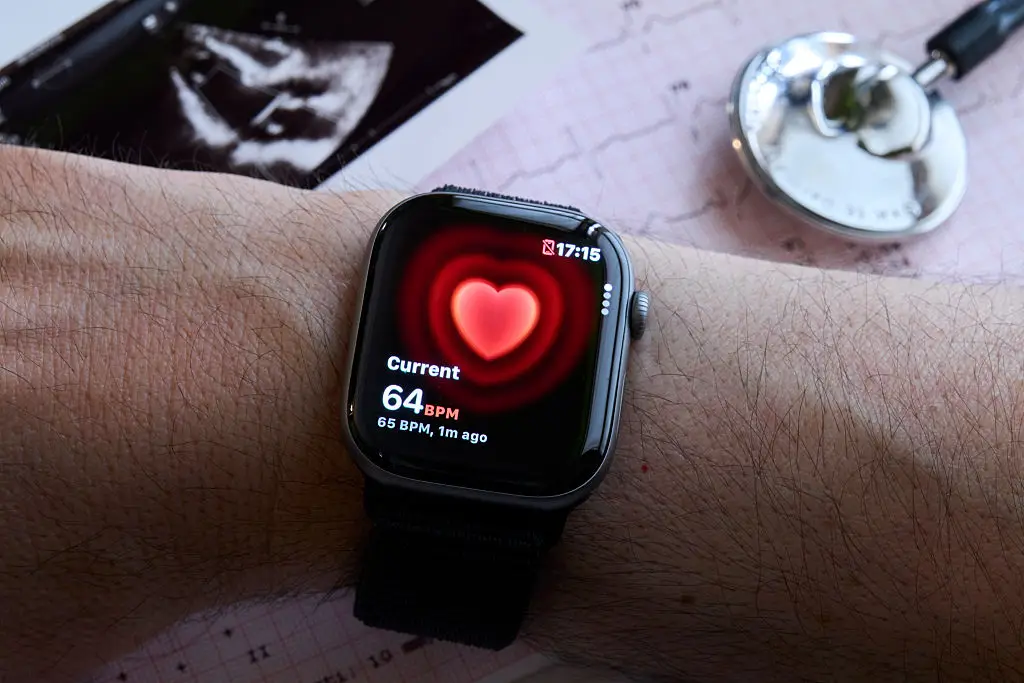 Good resting heart rates can range between 60 and 100 beats per minute, although that drops if you exercise frequently (Matteo Della Torre/NurPhoto via Getty Images)