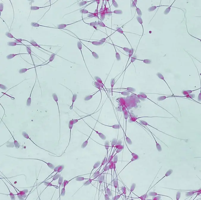 Sebastian Condrea/Getty Images