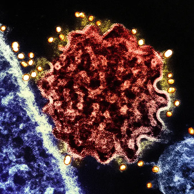 BSIP / Contributor / Getty