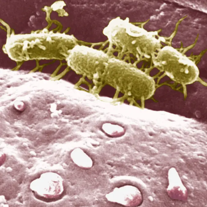 BSIP / Contributor / Getty