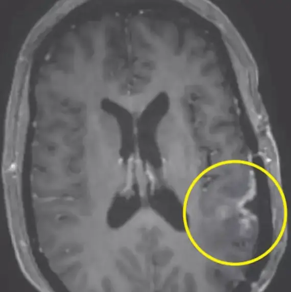 Mass General Brigham