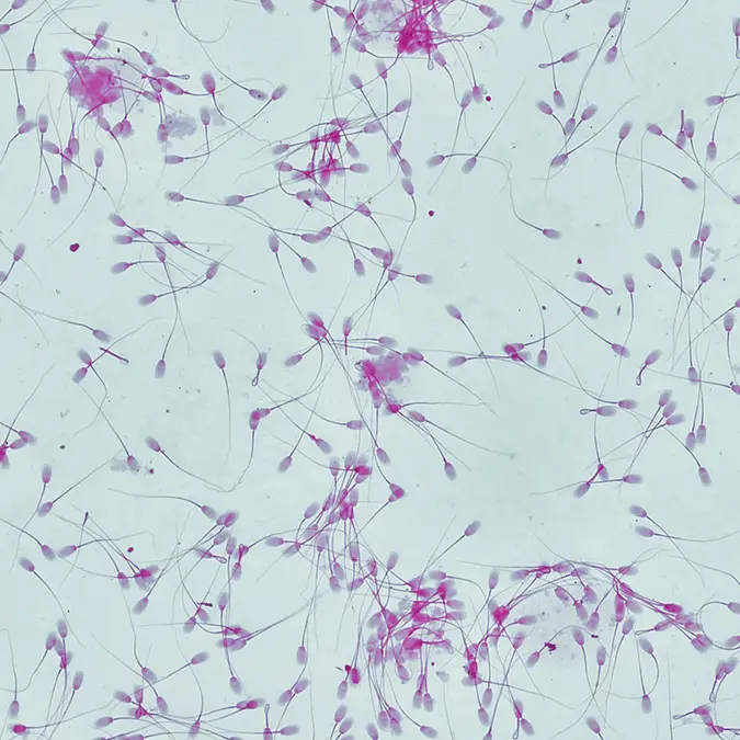 Sebastian Condrea / Getty