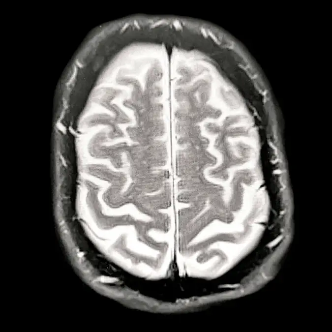 Peter Dazeley / Contributor / Getty