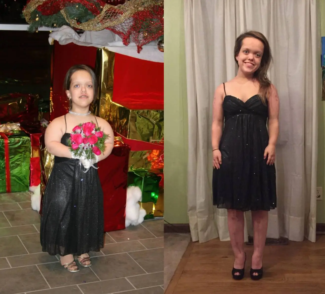 Crews first underwent surgery back in 2010 (Chandler Crews)