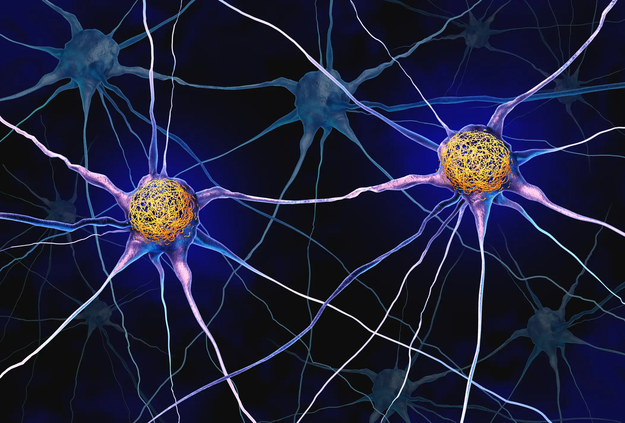 Arc proteins were transporting the toxic Tau to healthy brain cells, spreading Alzheimer's in a way that scientists previously weren't aware of (wildpixel/Getty Images)