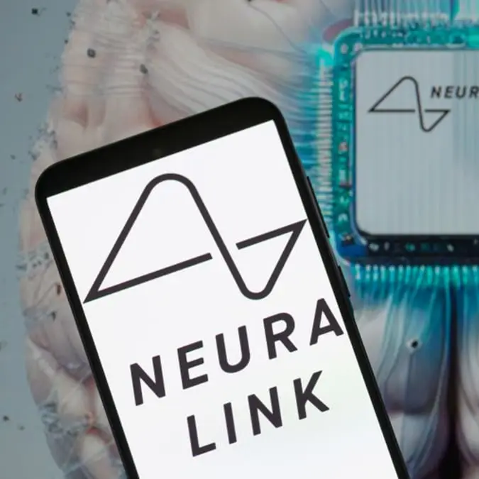 Jonathan Raa/NurPhoto via Getty Images