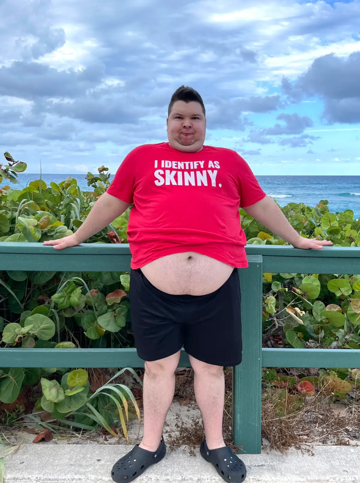 Nikocado Avocado shocked the entire internet after posting his infamous video '2 Steps Ahead' (real_nikocado/X)