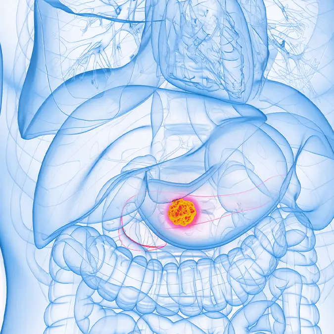 SEBASTIAN KAULITZKI/SCIENCE PHOTO LIBRARY / Getty