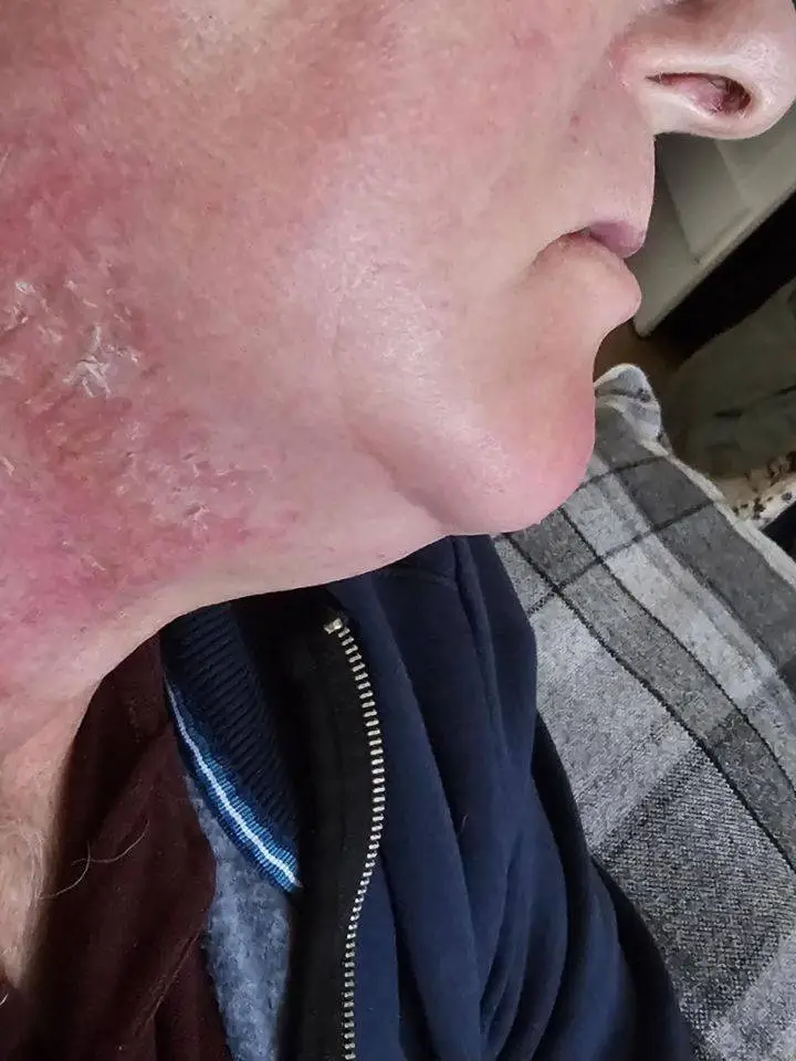 Frank Lane was surprised by his throat cancer diagnosis (Kennedy News and Media)