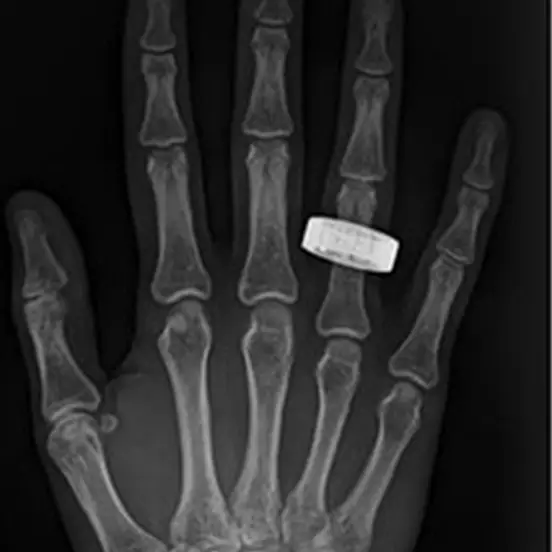 Gifford et al., Radiology