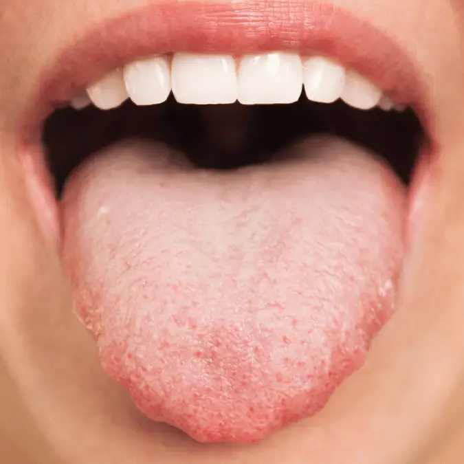 'Disgusting' bodily function called 'gleeking' is trending on TikTok and people didn't realize they could do it