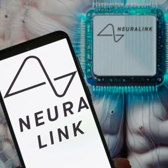 First Neuralink patient describes astonishing moment he realized he could control his computer with his thoughts