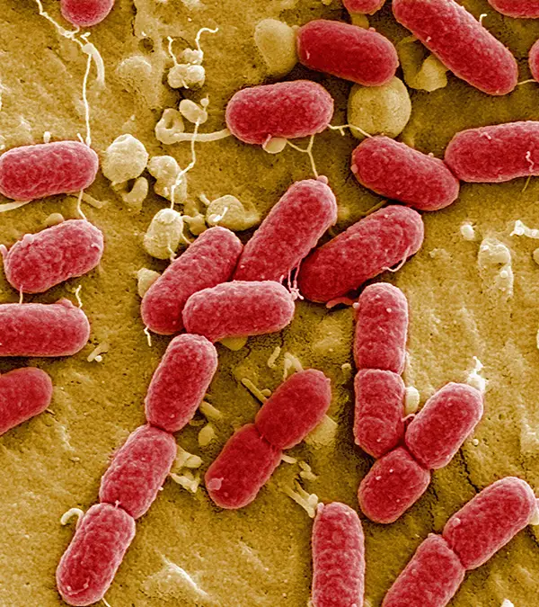 Scientists believe to have found a breakthrough with a new antibiotic drug / Handout/Steve Gschmeissner/Science Photo Library/Getty Images