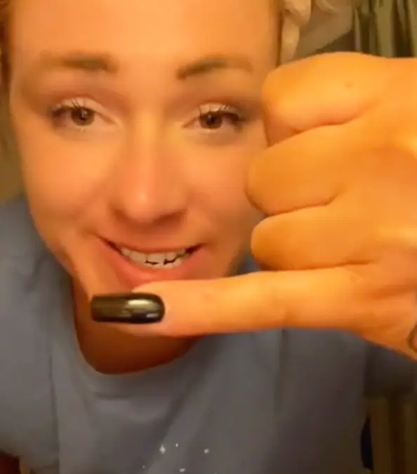 Smartphone overuse can cause a pinky indentation / dr.karanr/TikTok