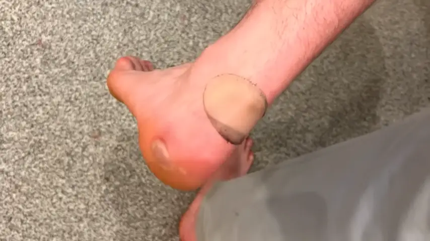 Turns out walking that many steps has painful consequences (YouTube/JackSucksAtLife)