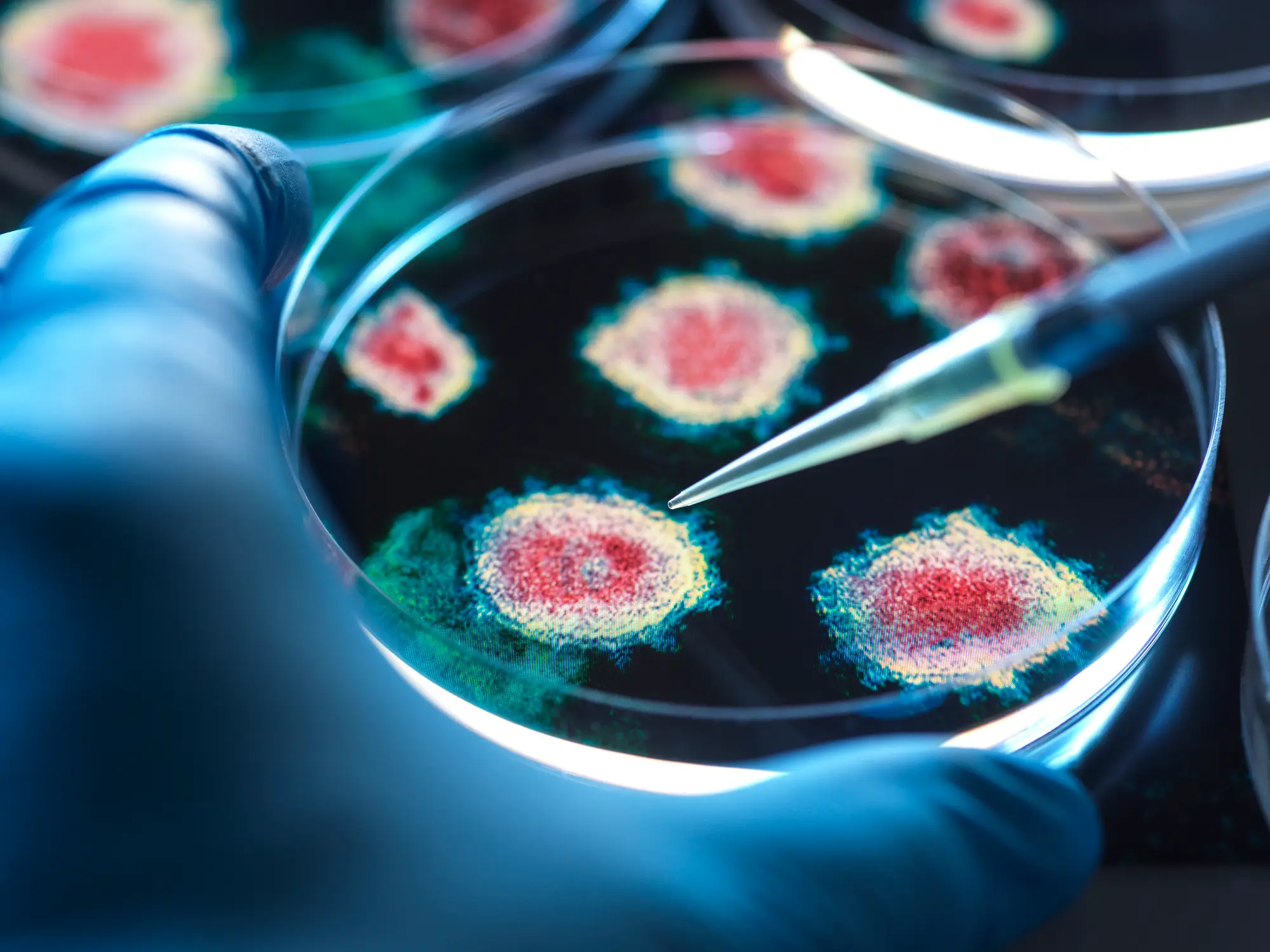 The new virus was discovered by scientists (TEK IMAGE/SCIENCE PHOTO LIBRARY/Getty Images)