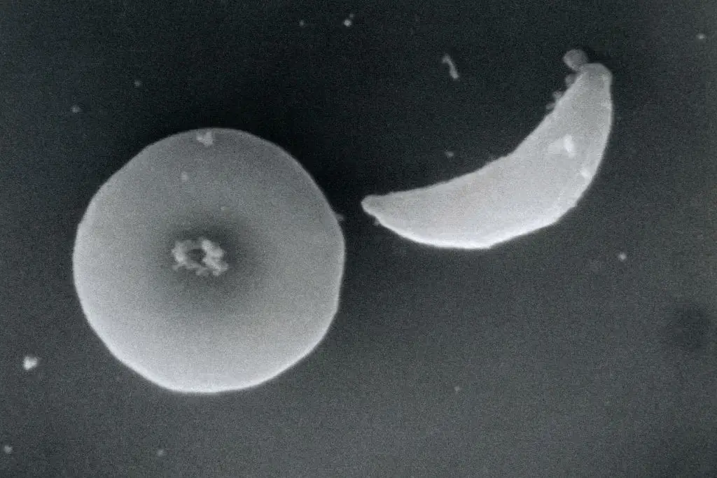 New research could help identify T. gondii and minimize the effects it has on your brain (BSIP/UIG Via Getty Images)