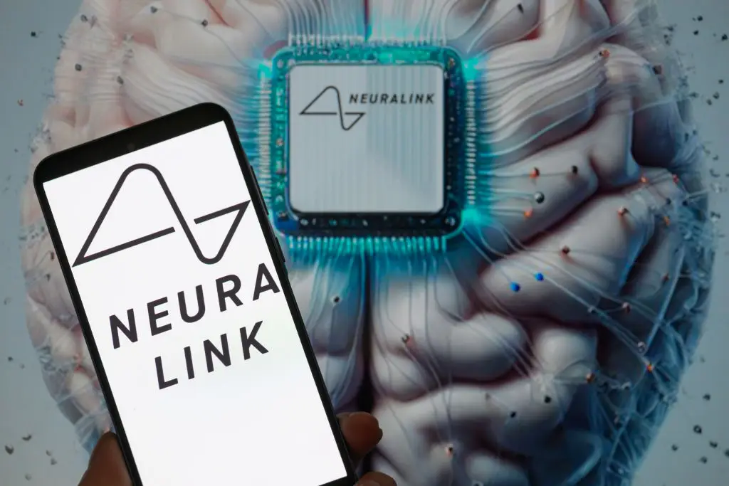 Noland Arbaugh became Neuralink’s first patient to test the neurotech firm’s chip (Jonathan Raa/NurPhoto via Getty Images)