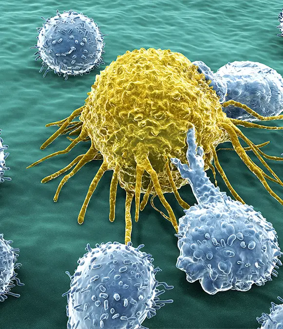 JUAN GARTNER / Getty