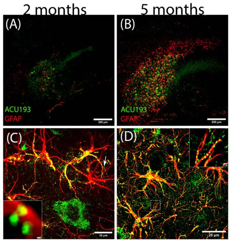NU-9 trials continue (Kranz et al., Alzheimer's & Dementia, 2025)