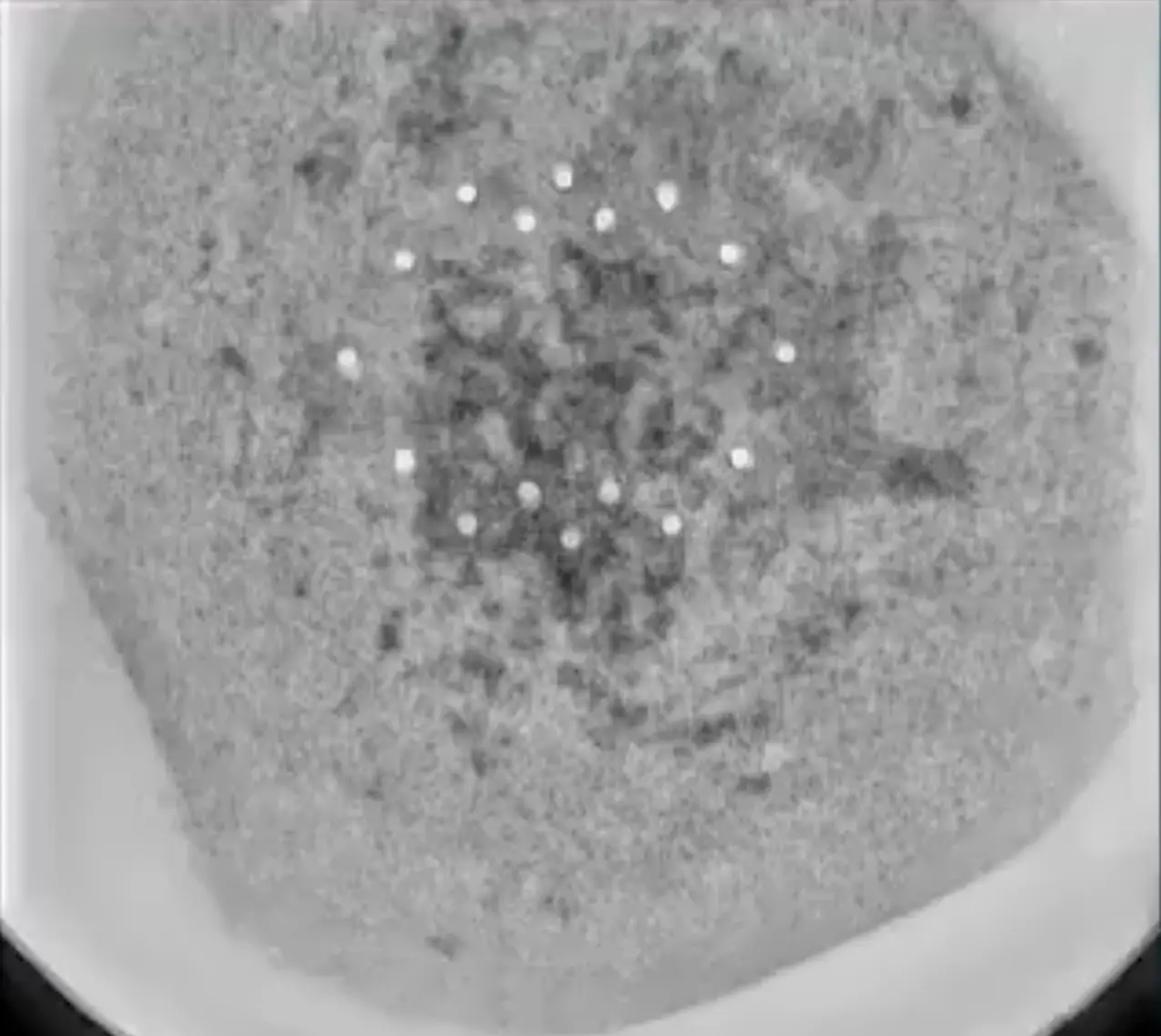 X-rays of the strange UFO-like sphere reveal 18 non-random 'microspheres' linked to a central 'chip' (X/@truthpolex)